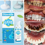 Carregar imagem no visualizador da galeria, Diasmile™ Branqueamento de super dentes de ervas puras &amp; Espuma de reparação bucal
